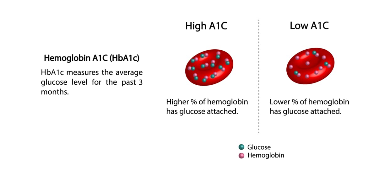 An image showing text reading: 'Hemoglobin A1C(Hb1Cc) HbA1c measures the average glucose level for the past 3 months.' And a picture of High A1C and Low A1C.